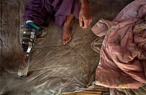 Photo: Giovanni Diffidenti via ICBL on flickr https://www.flickr.com/photos/minefreeworld/